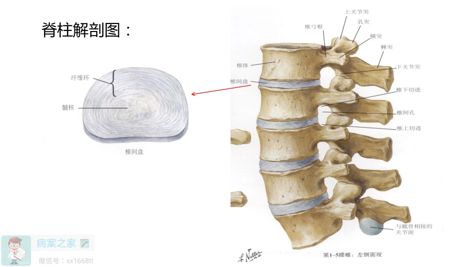 脊柱融合术ICD-10-CM3编码解析_第3页