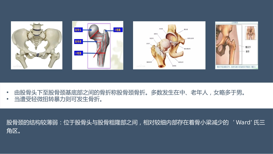 髋关节置换术后护理医学类(1)_第3页