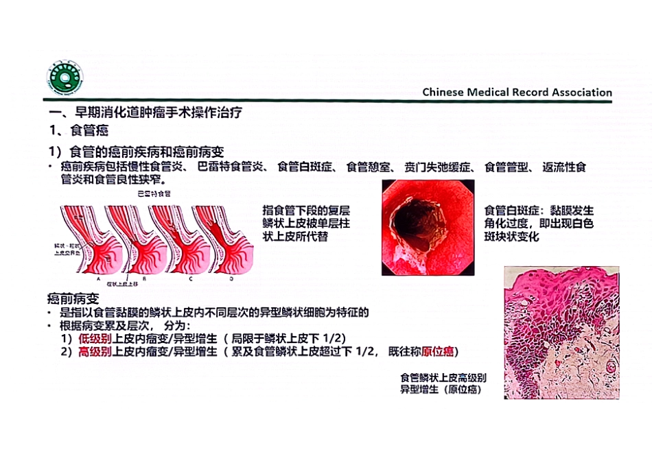 消化道肿瘤根治性手术的编码要点_第3页