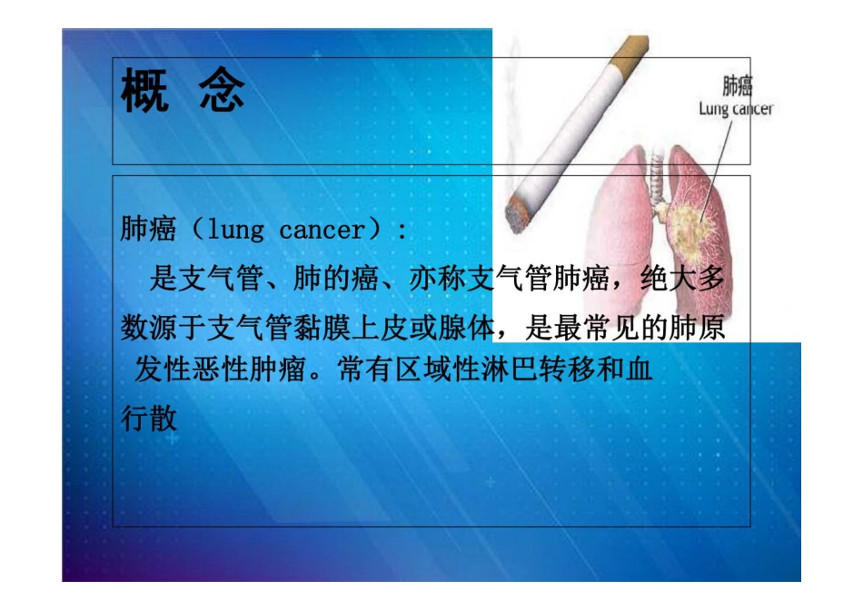 肺癌患者的护理_第3页