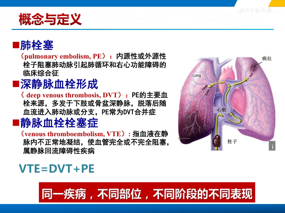 急性肺栓塞的诊疗原则.pdf_第2页