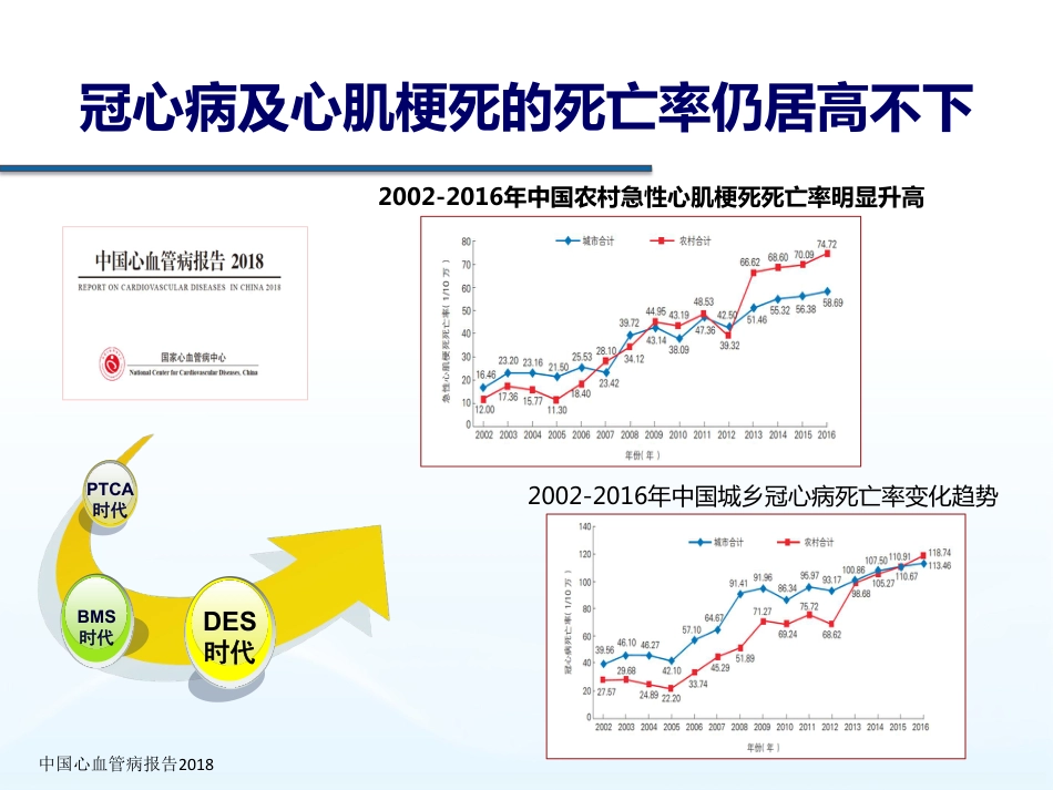 解读：急性ST段抬高型心肌梗死诊断和治疗指南.pdf_第2页