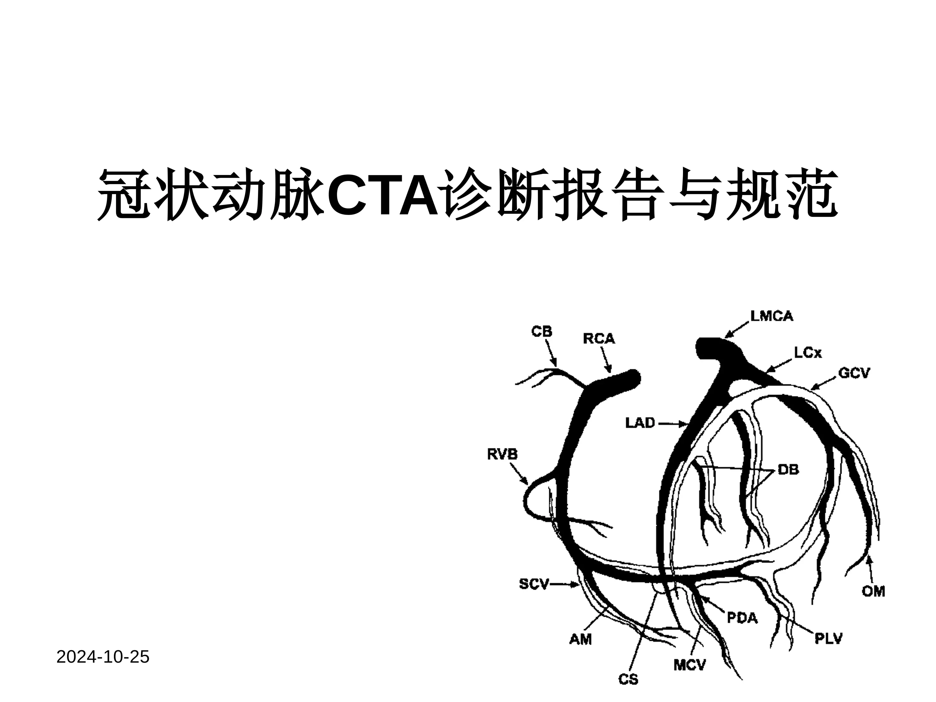 冠状动脉CTA诊断报告与规范_第1页