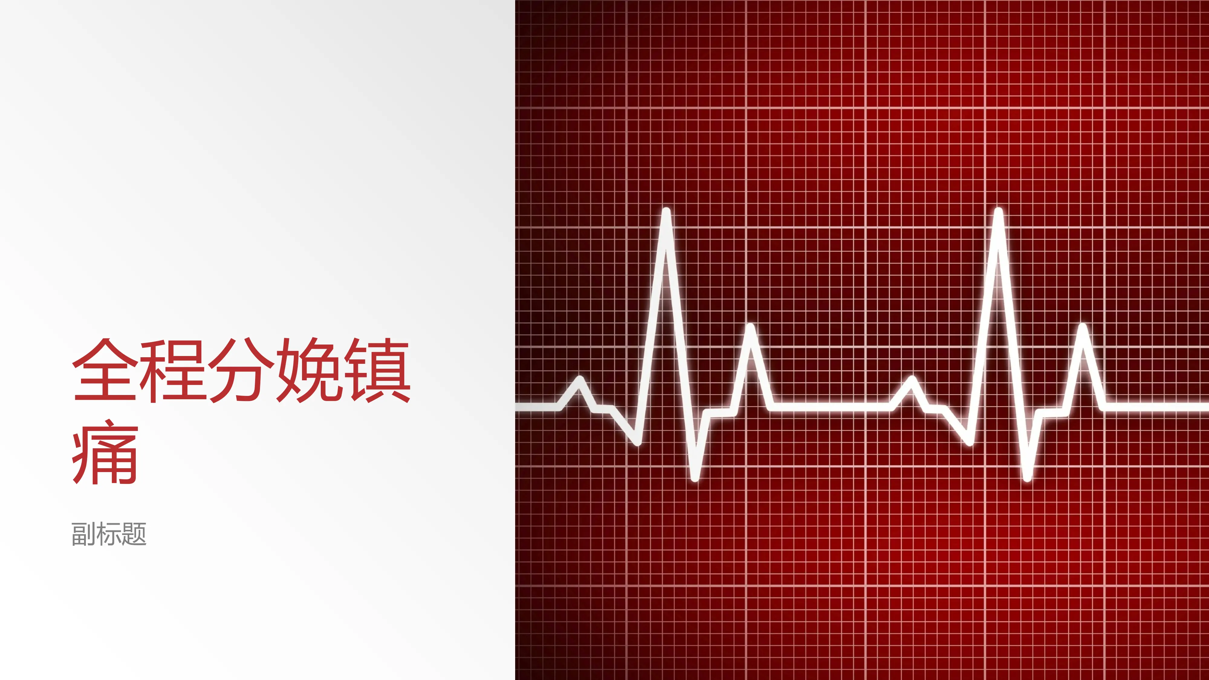 全程分娩镇痛_第1页