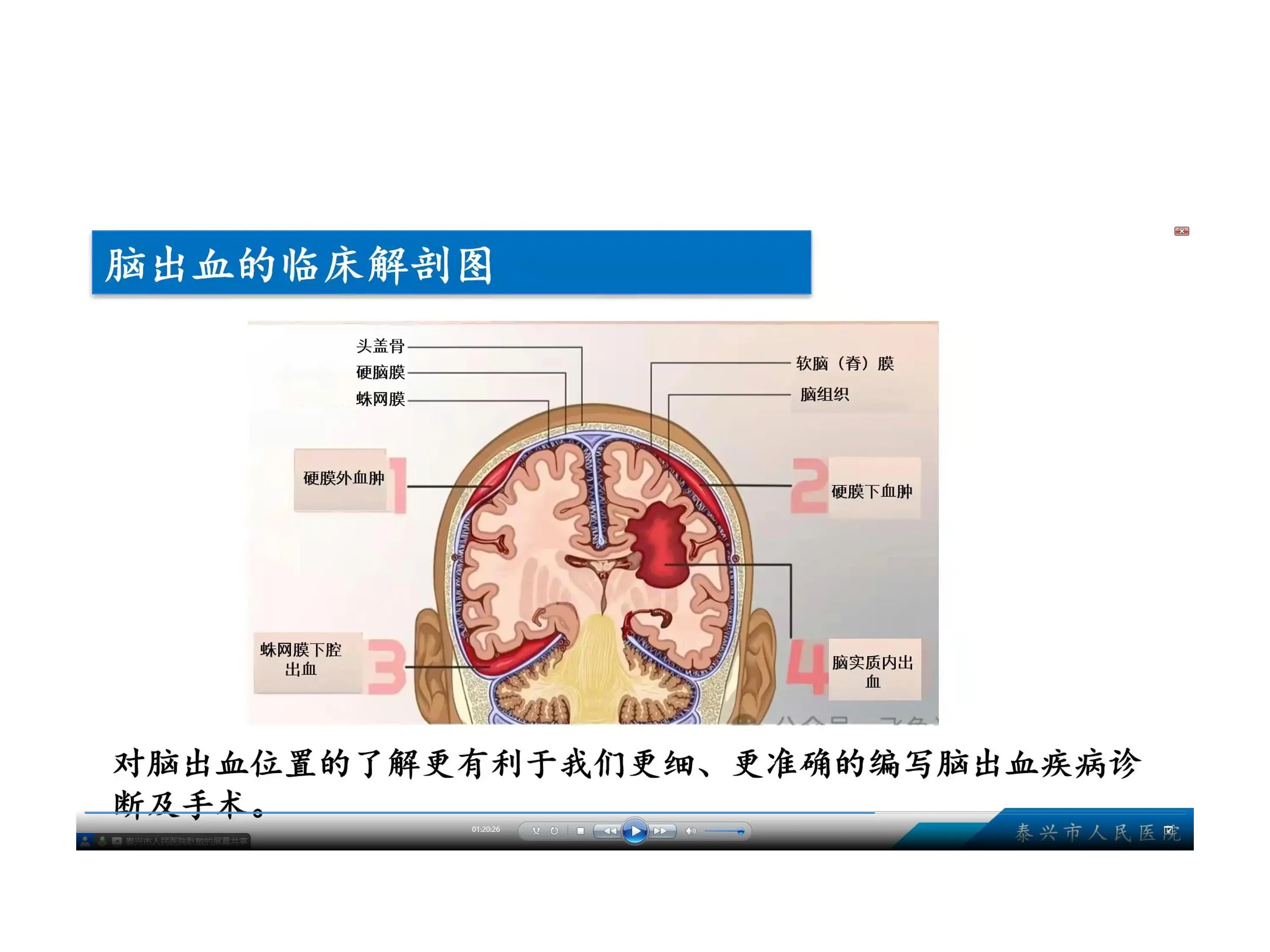 神经外科常见问题编码_第2页