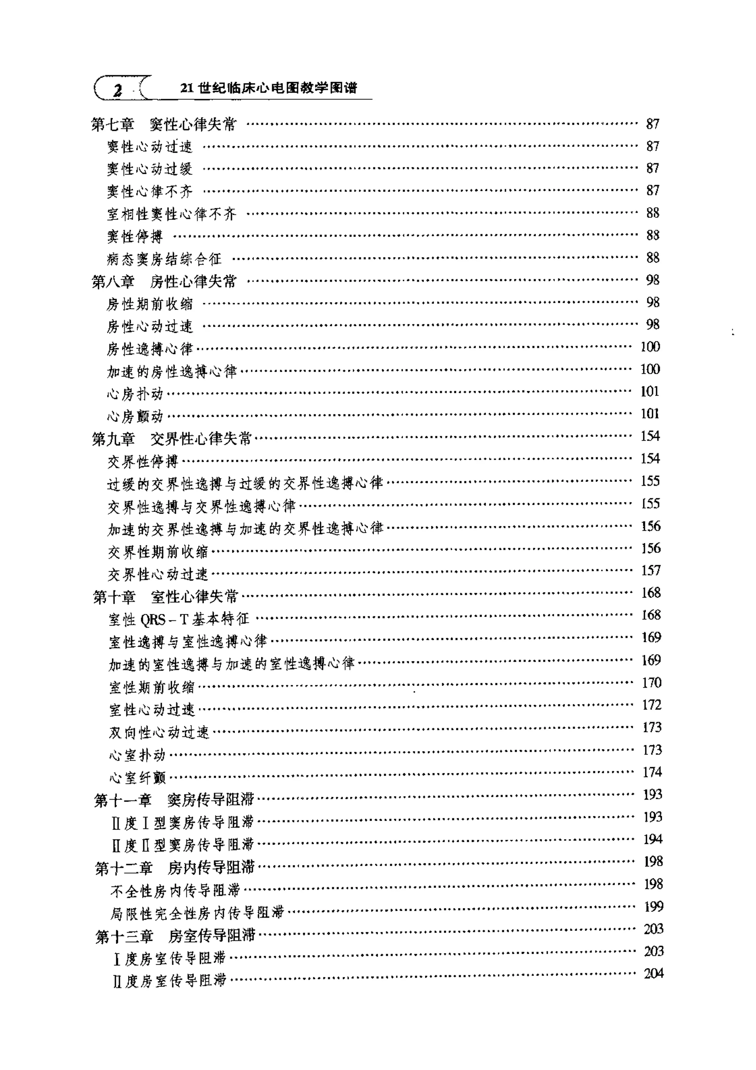 临床心电图教学图谱_第2页