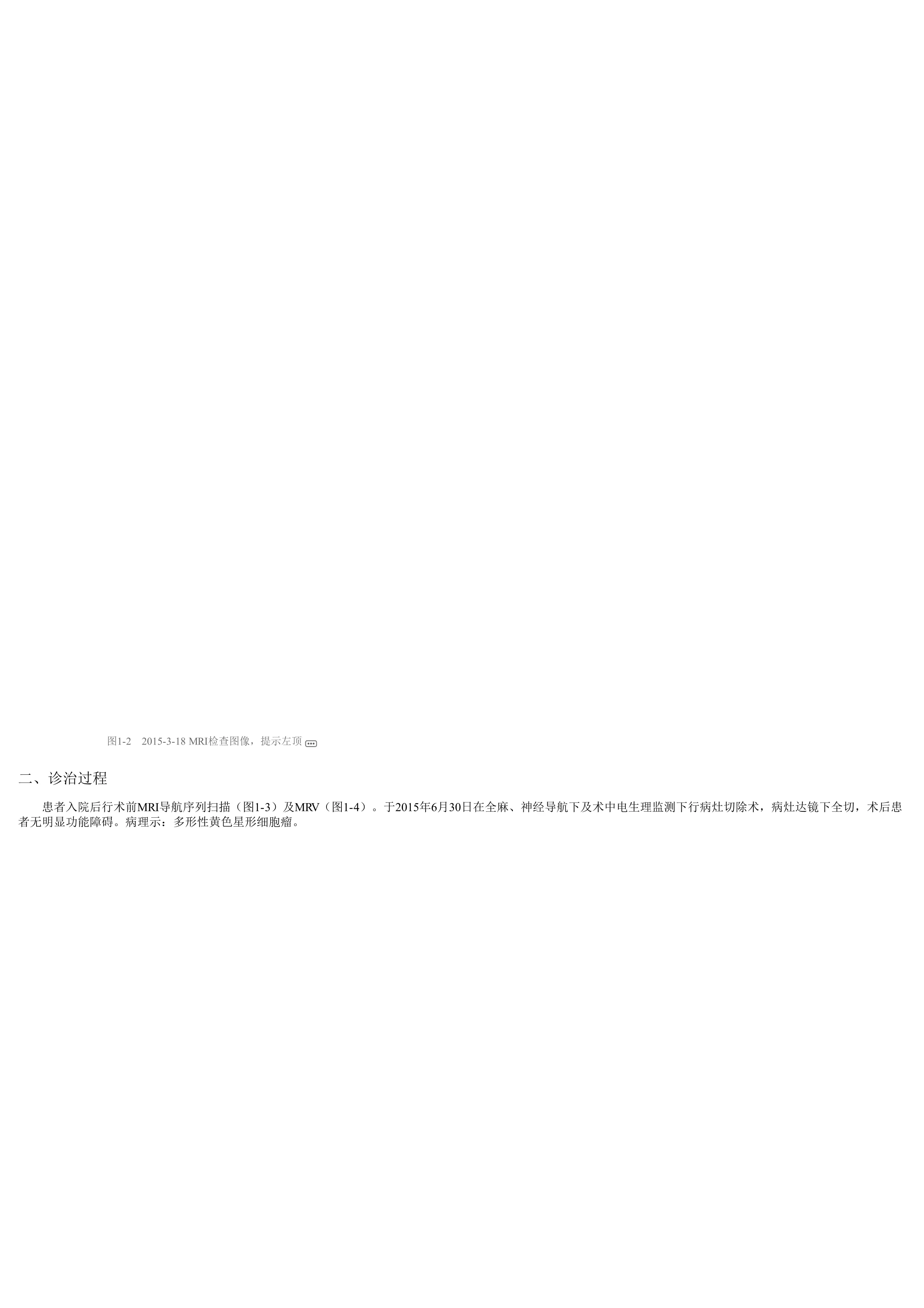 神经系统肿瘤病例析评.pdf_第3页