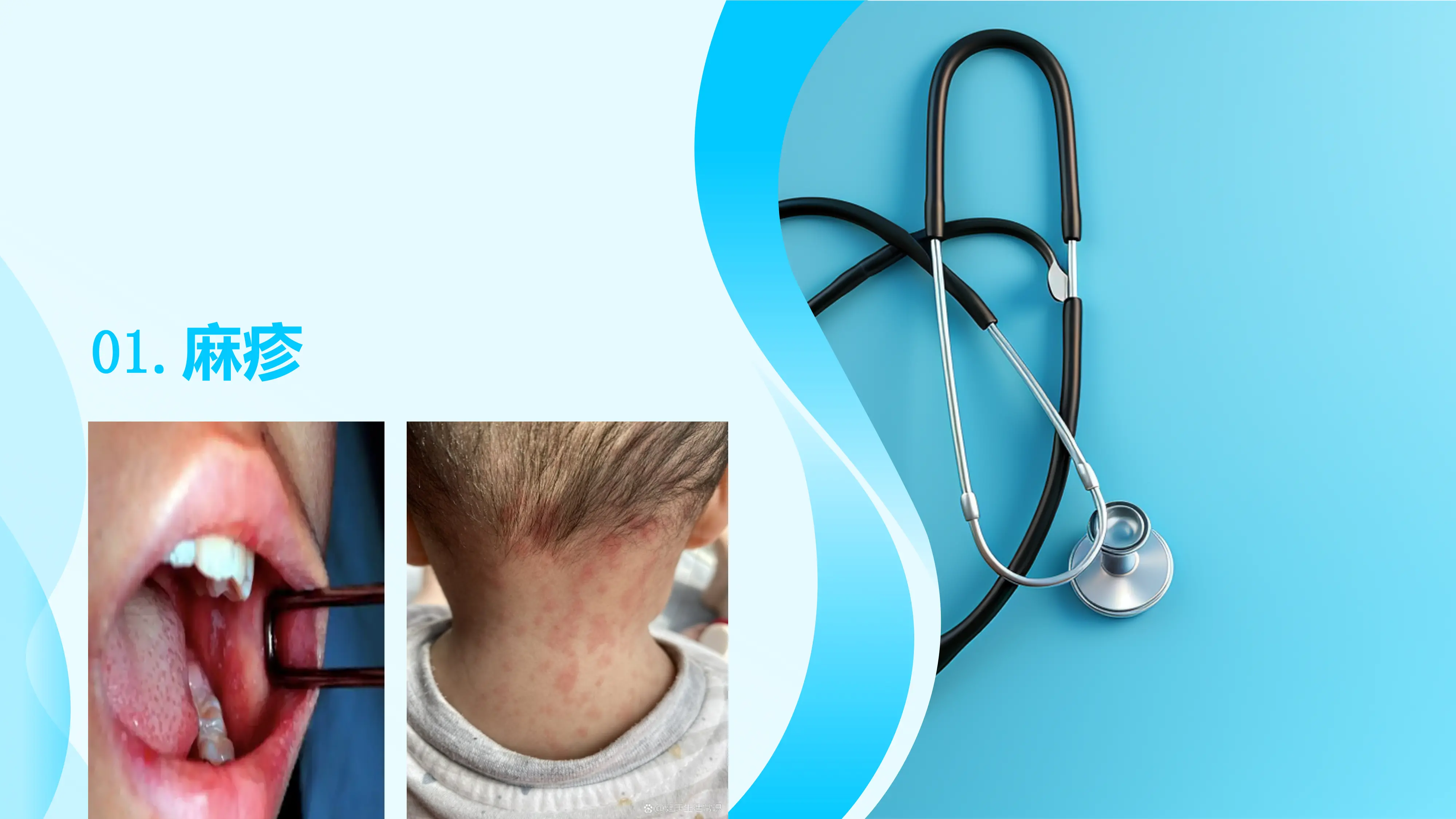 常见传染病诊断标准与报告规范(1)_第3页