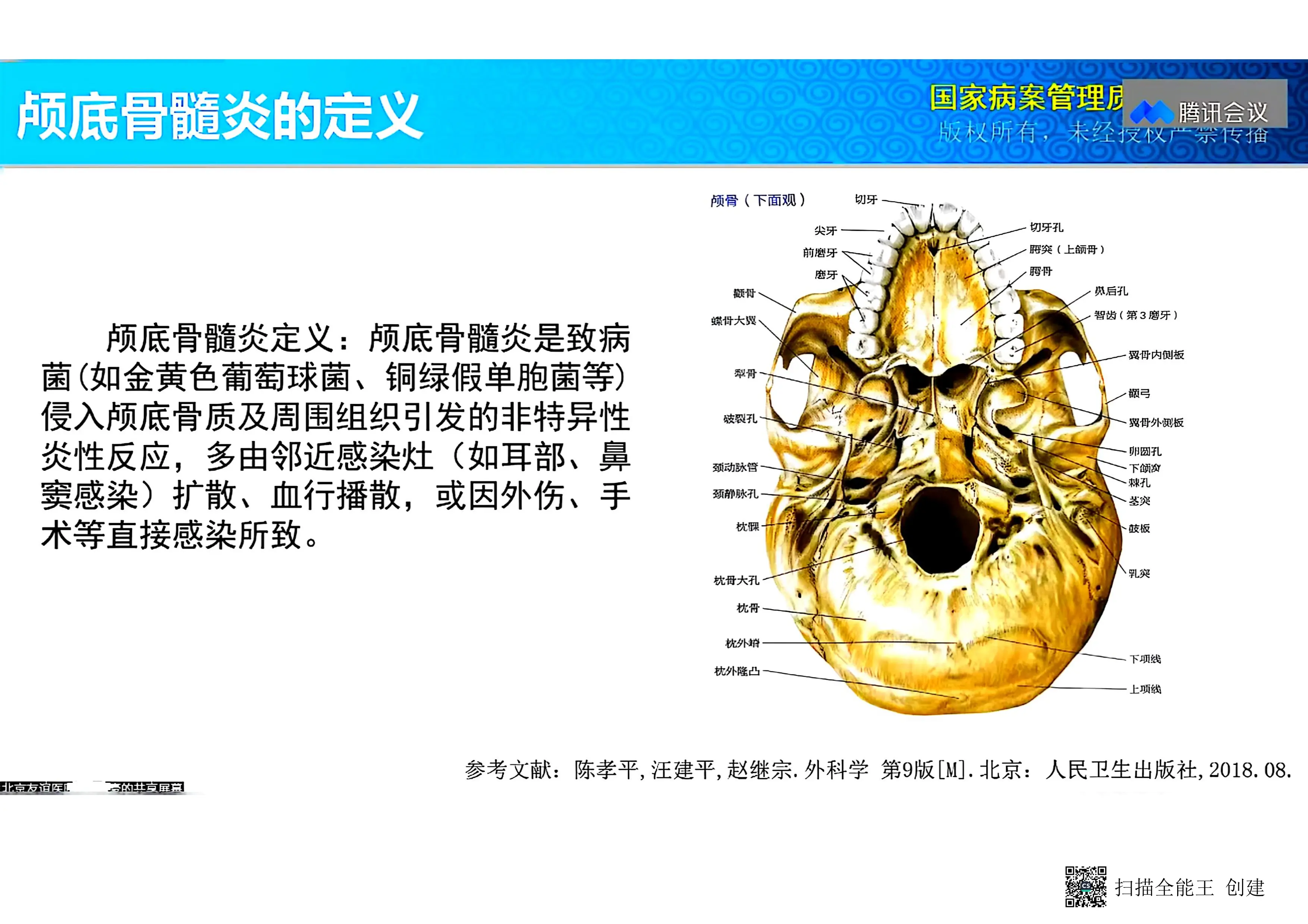 颅底骨髓炎的诊断和手术编码.pdf_第3页