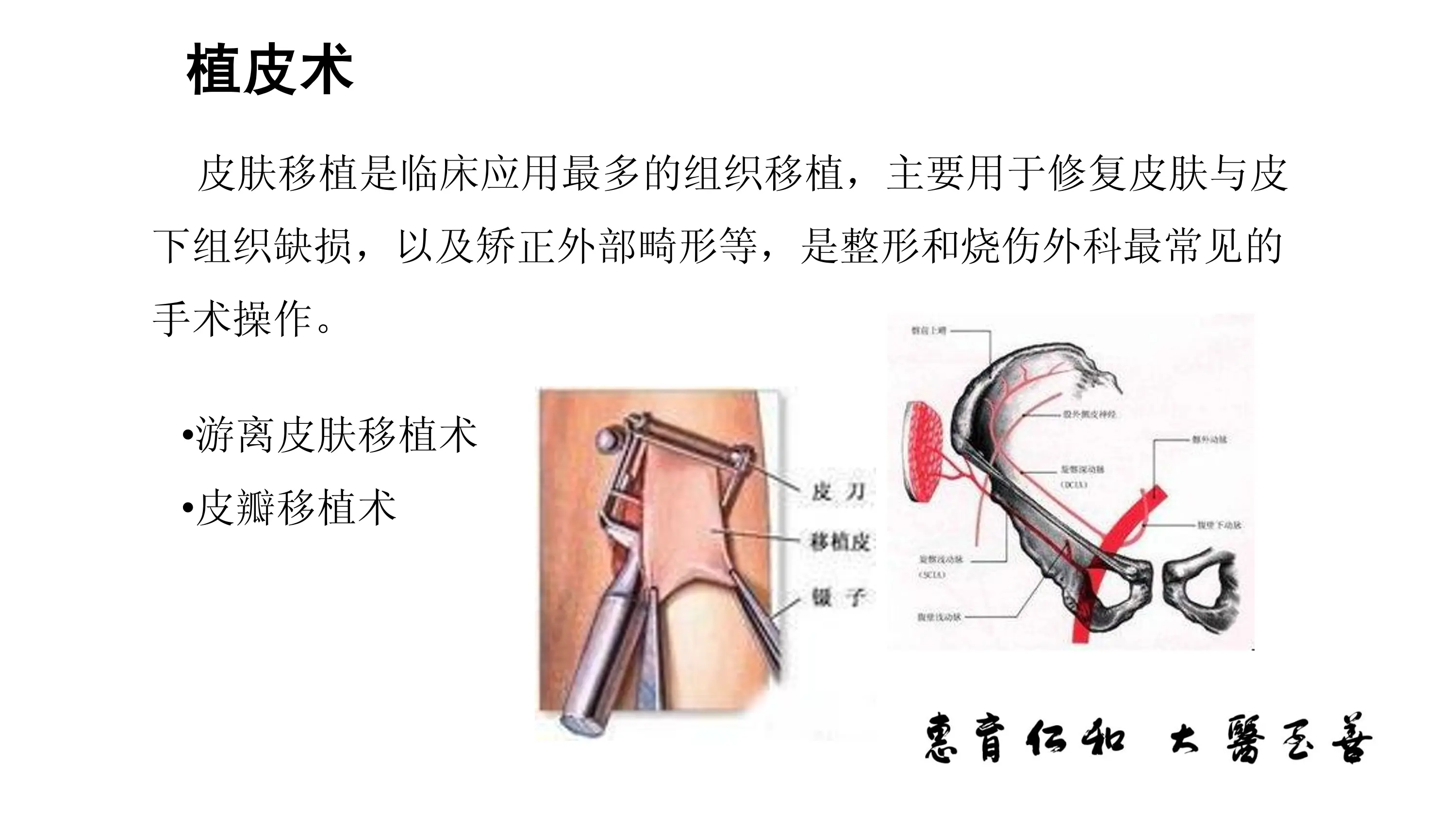 皮肤移植术编码要点.pdf_第2页