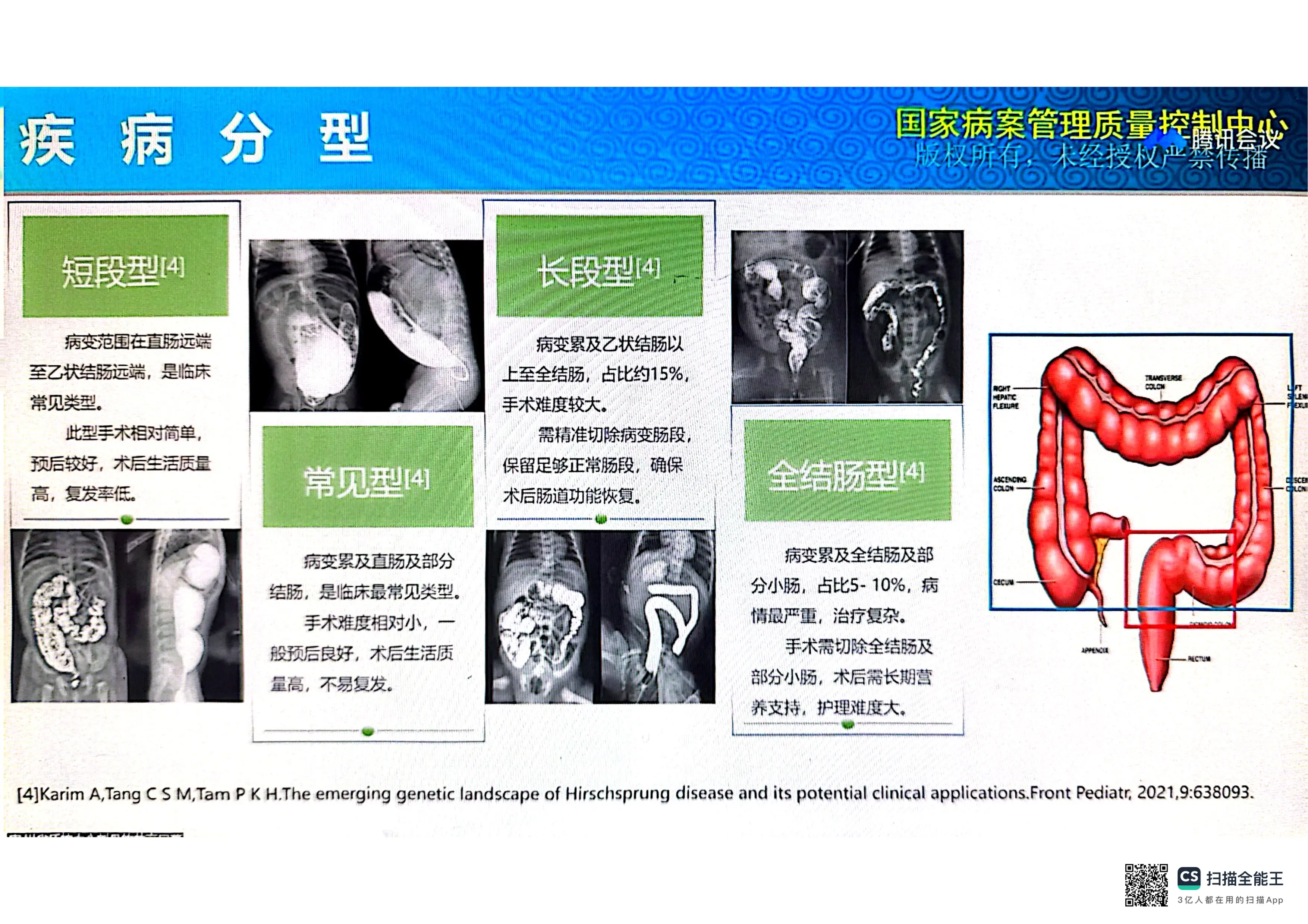 先天性巨结肠疾病与手术编码.pdf_第3页